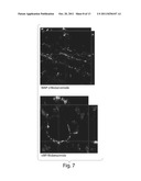 TREATMENT OF BRAIN DAMAGE USING UMBILICAL CORD BLOOD CELLS diagram and image