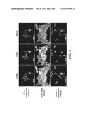 CHONDROGENIC PROGENITOR CELLS, PROTOCOL FOR DERIVATION OF CELLS AND USES     THEREOF diagram and image