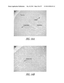 AMNIOTIC FLUID CELLS AND USES THEREOF diagram and image