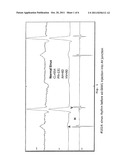 Compensating for Atrioventricular Block Using a Nucleic Acid Encoding a     Sodium Channel or Gap Junction Protein diagram and image