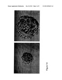 Use of 8-Quinolinol and its Analogs to Target Cancer Stem Cells diagram and image