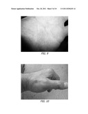 METHODS AND COMPOSITIONS OF CANNABIS EXTRACTS diagram and image