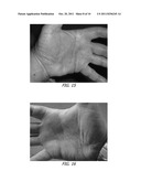 METHODS AND COMPOSITIONS OF CANNABIS EXTRACTS diagram and image