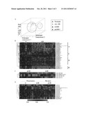 MicroRNAa (miRNA) AS BIOMARKERS FOR DIAGNOSING DIFFERENT GRADES OF GLIOMAS     AND PATHWAYS OF GLIOMA PROGRESSION diagram and image