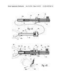 VENTRICULAR FUNCTION ASSISTING DEVICE AND A METHOD AND APPARATUS FOR     IMPLANTING IT diagram and image