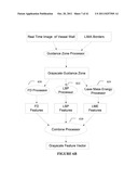 ATHEROMATIC?: IMAGING BASED SYMPTOMATIC CLASSIFICATION AND CARDIOVASCULAR     STROKE INDEX ESTIMATION diagram and image