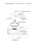 ATHEROMATIC?: IMAGING BASED SYMPTOMATIC CLASSIFICATION AND CARDIOVASCULAR     STROKE INDEX ESTIMATION diagram and image