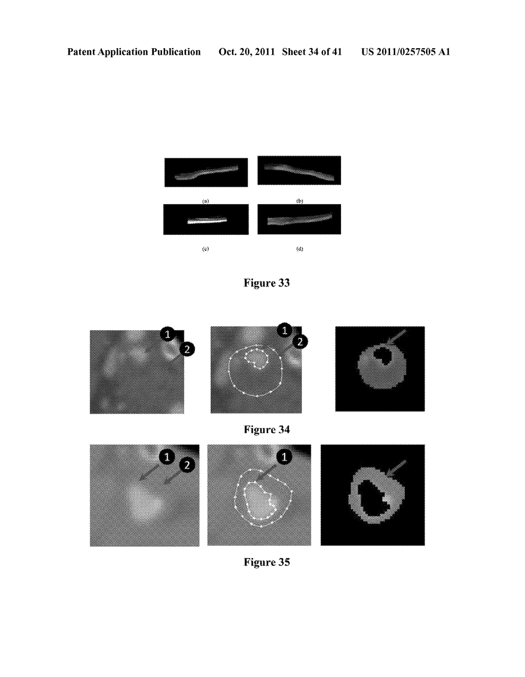 ATHEROMATIC?: IMAGING BASED SYMPTOMATIC CLASSIFICATION AND CARDIOVASCULAR     STROKE INDEX ESTIMATION - diagram, schematic, and image 35