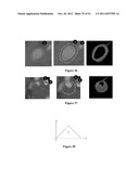 ATHEROMATIC?: IMAGING BASED SYMPTOMATIC CLASSIFICATION AND CARDIOVASCULAR     STROKE INDEX ESTIMATION diagram and image