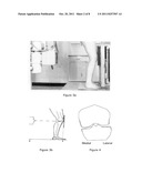 MORPHOMETRY OF THE HUMAN KNEE JOINT AND PREDICTION FOR OSTEOARTHRITIS diagram and image