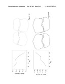 MORPHOMETRY OF THE HUMAN KNEE JOINT AND PREDICTION FOR OSTEOARTHRITIS diagram and image