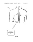 COORDINATION OF FUNCTIONAL MRI SCANNING AND ELECTRICAL STIMULATION THERAPY diagram and image