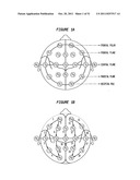 Patient-Specific Seizure Onset Detection System diagram and image