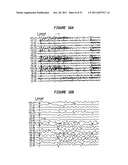 Patient-Specific Seizure Onset Detection System diagram and image