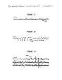 Patient-Specific Seizure Onset Detection System diagram and image