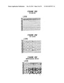 Patient-Specific Seizure Onset Detection System diagram and image