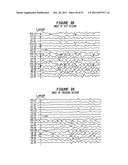 Patient-Specific Seizure Onset Detection System diagram and image