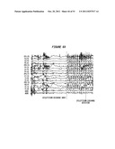 Patient-Specific Seizure Onset Detection System diagram and image