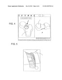 COMPUTER-AIDED OSTEOPLASTY SURGERY SYSTEM diagram and image