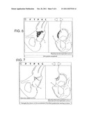 COMPUTER-AIDED OSTEOPLASTY SURGERY SYSTEM diagram and image