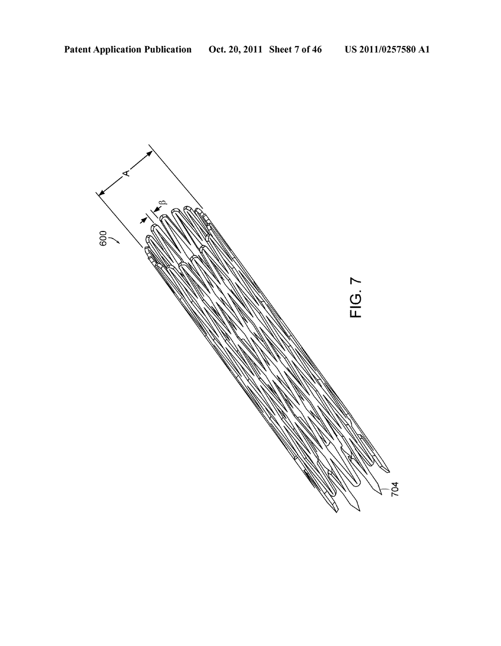 INTESTINAL SLEEVE - diagram, schematic, and image 08