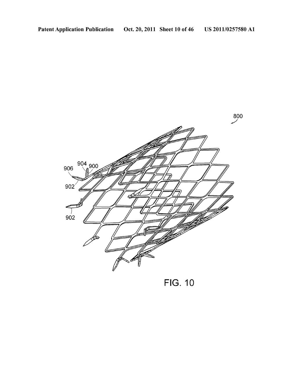 INTESTINAL SLEEVE - diagram, schematic, and image 11