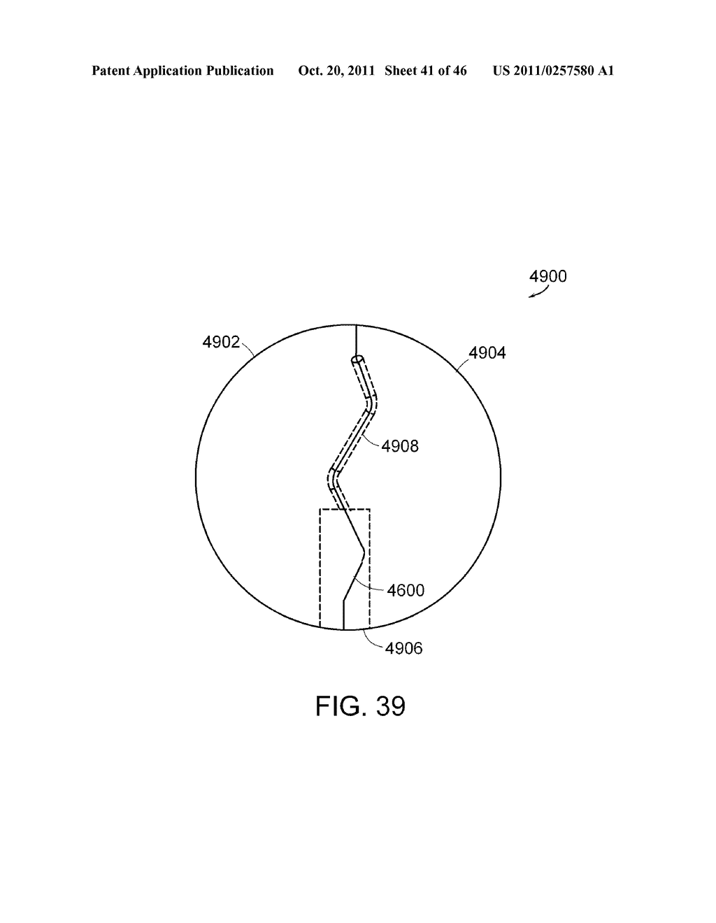 INTESTINAL SLEEVE - diagram, schematic, and image 42