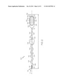 Filament Implant System and Method diagram and image