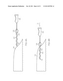 Filament Implant System and Method diagram and image