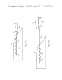 Filament Implant System and Method diagram and image