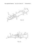 Filament Implant System and Method diagram and image