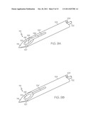 Filament Implant System and Method diagram and image