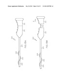 Filament Implant System and Method diagram and image