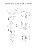 Shapeable or Steerable Guide Sheaths and Methods for Making and Using Them diagram and image