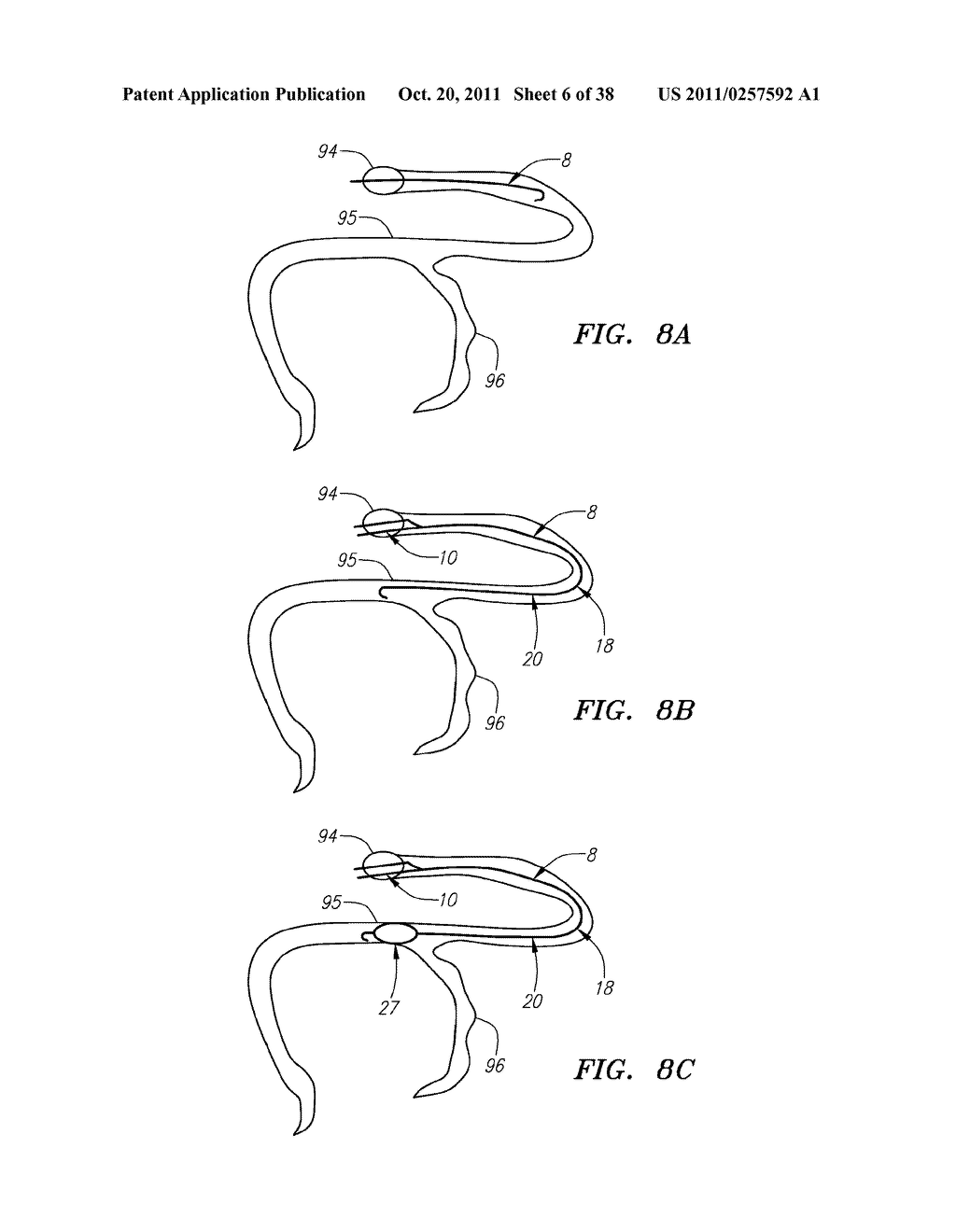 Shapeable or Steerable Guide Sheaths and Methods for Making and Using Them - diagram, schematic, and image 07