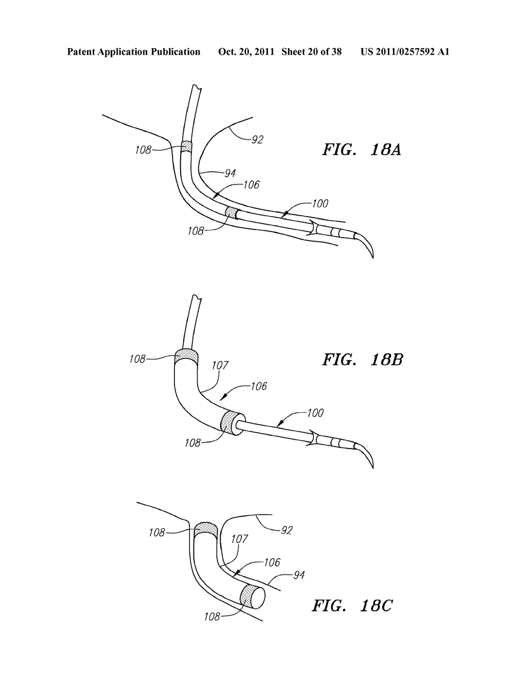 Shapeable or Steerable Guide Sheaths and Methods for Making and Using Them - diagram, schematic, and image 21