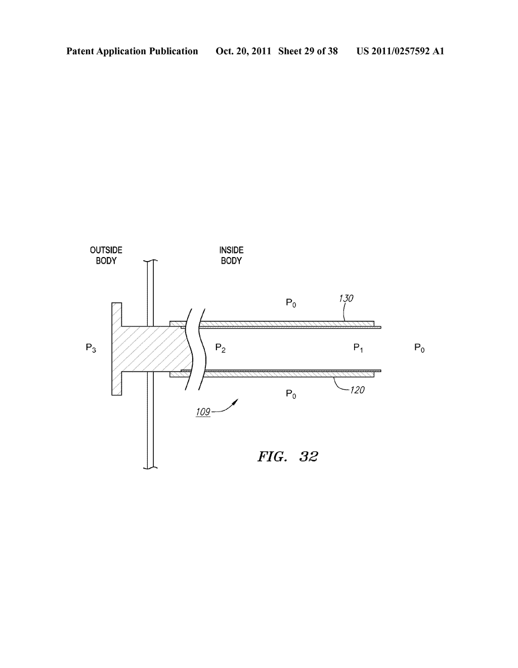 Shapeable or Steerable Guide Sheaths and Methods for Making and Using Them - diagram, schematic, and image 30