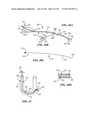 Shapeable or Steerable Guide Sheaths and Methods for Making and Using Them diagram and image