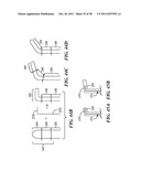 Shapeable or Steerable Guide Sheaths and Methods for Making and Using Them diagram and image