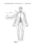 INFUSION SYSTEM PROGRAMMABLE IN FLEX MODE diagram and image