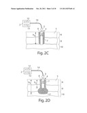 System and method for microablation of tissue diagram and image