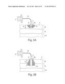 System and method for microablation of tissue diagram and image