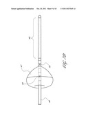 SYSTEMS AND METHODS FOR TREATING A HOLLOW ANATOMICAL STRUCTURE diagram and image