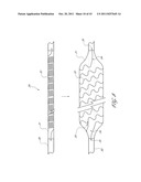 SYSTEMS AND METHODS FOR TREATING A HOLLOW ANATOMICAL STRUCTURE diagram and image