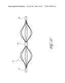 SYSTEMS AND METHODS FOR TREATING A HOLLOW ANATOMICAL STRUCTURE diagram and image