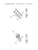 SYSTEMS AND METHODS FOR TREATING A HOLLOW ANATOMICAL STRUCTURE diagram and image