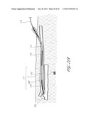 SYSTEMS AND METHODS FOR TREATING A HOLLOW ANATOMICAL STRUCTURE diagram and image