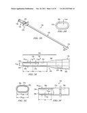 APPARATUS FOR IMPLANTING AN ELECTRICAL STIMULATION LEAD diagram and image