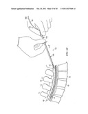 APPARATUS FOR IMPLANTING AN ELECTRICAL STIMULATION LEAD diagram and image