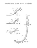 APPARATUS FOR IMPLANTING AN ELECTRICAL STIMULATION LEAD diagram and image